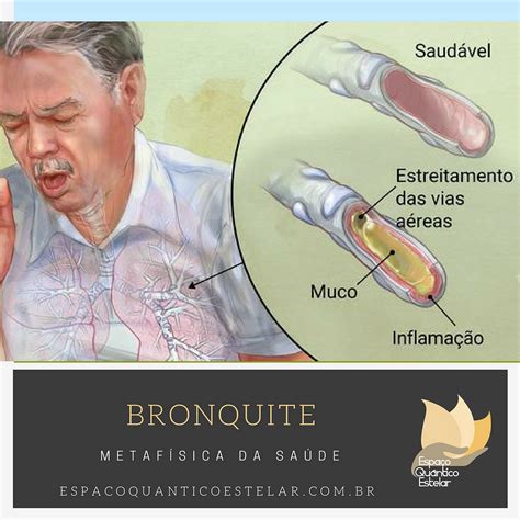 bronquite é perigoso-4